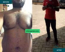 Tope's Transformation