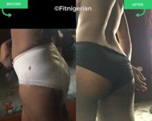 PFP Before & After Pictures 3